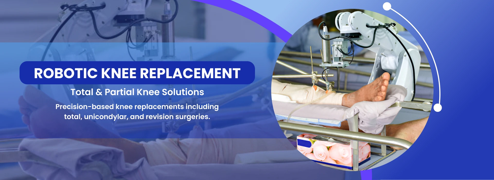 Robotic Knee Replacement
