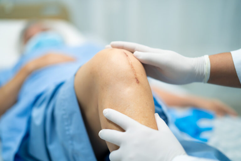 Knee Replacement Surgeon  in Jayanagar Bangalore