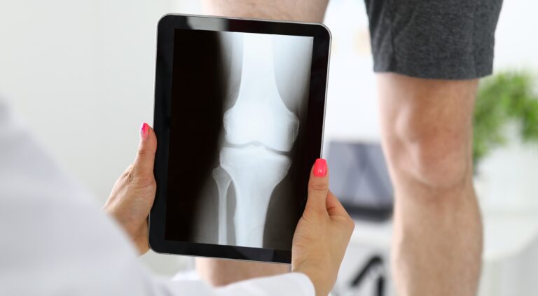 TKR Replacement Surgeon  in Jayanagar Bangalore